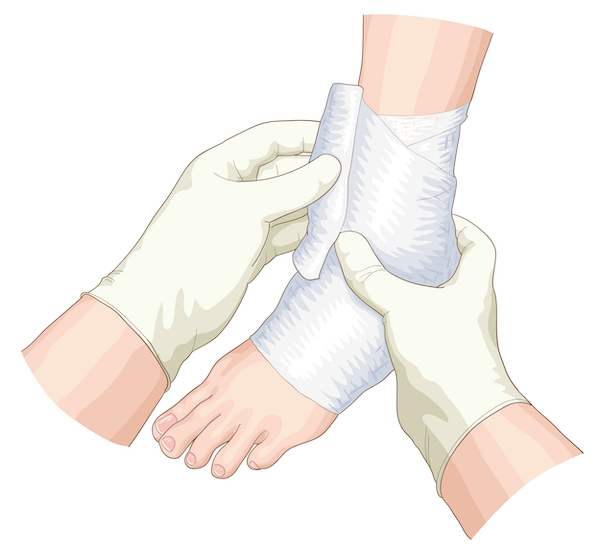 Common Foot Injuries From Falling - Foot Care Products - FootDocStore