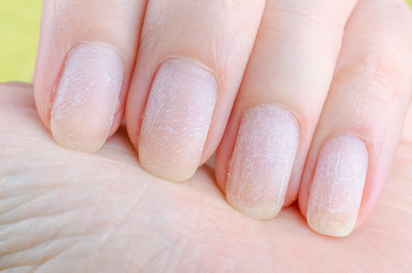 Nails